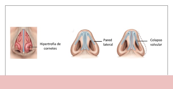 Nota Principal